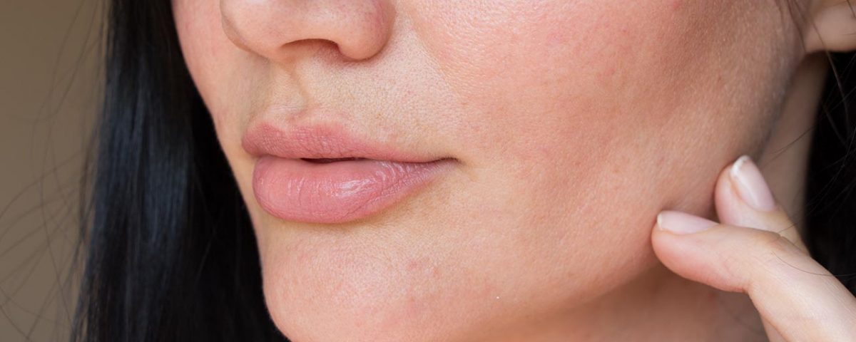 What Alcohol Does to Your Skin