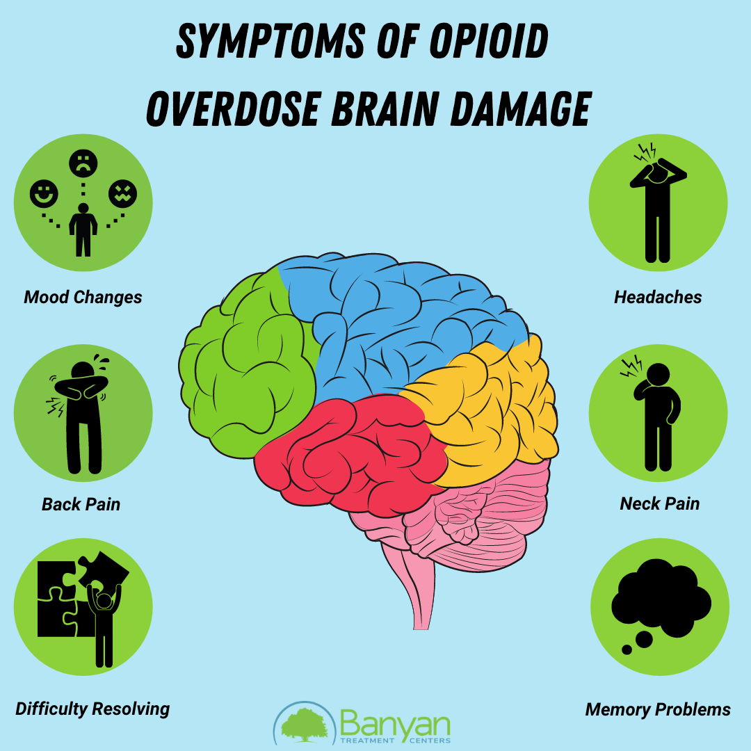 Symptoms of Opioid Overdose Brain Damage
