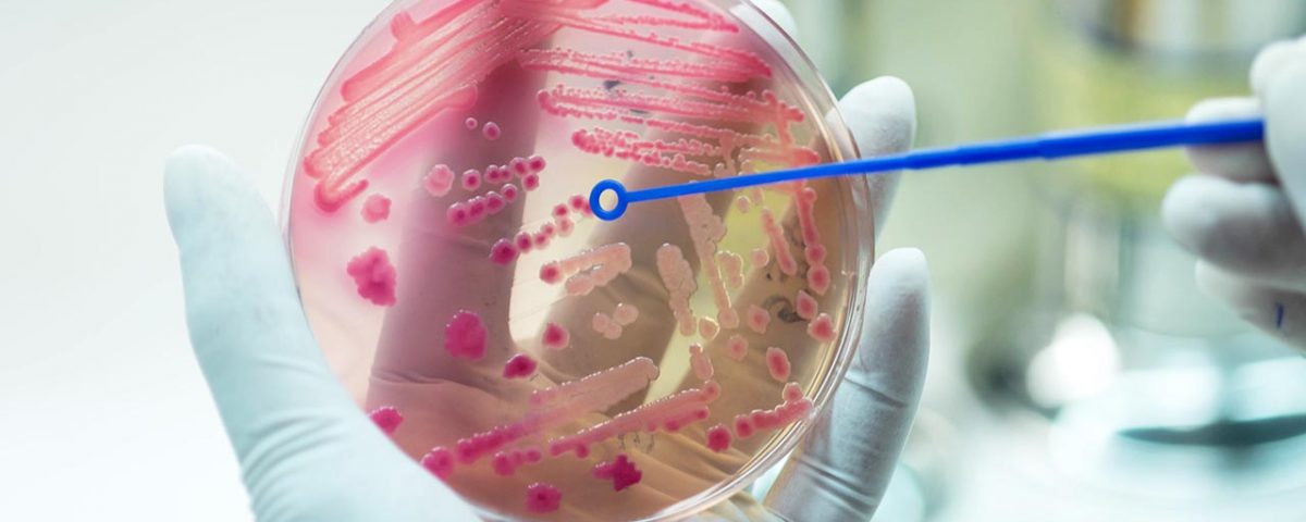 The Connection Between Addiction and Sepsis