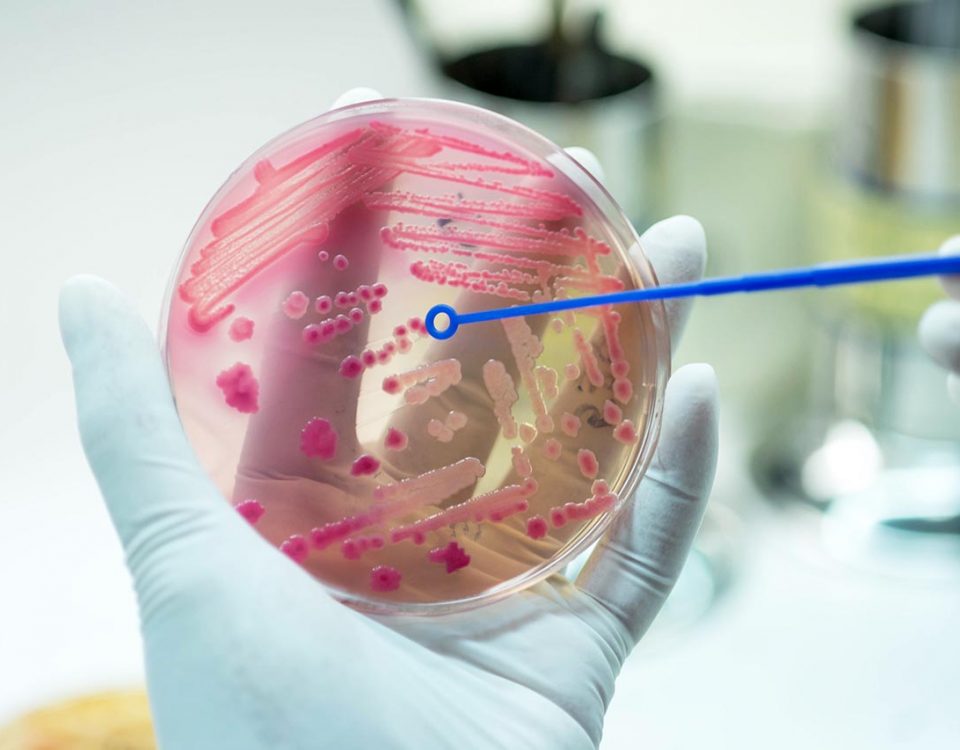 The Connection Between Addiction and Sepsis