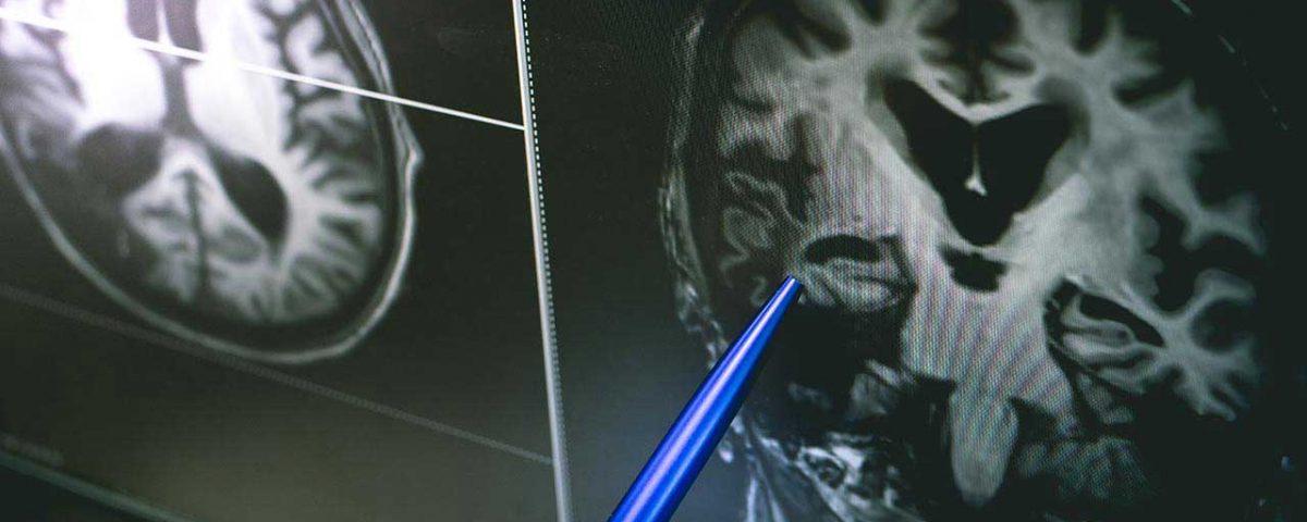 Addiction & The Brain: How Drugs Affect the Brain