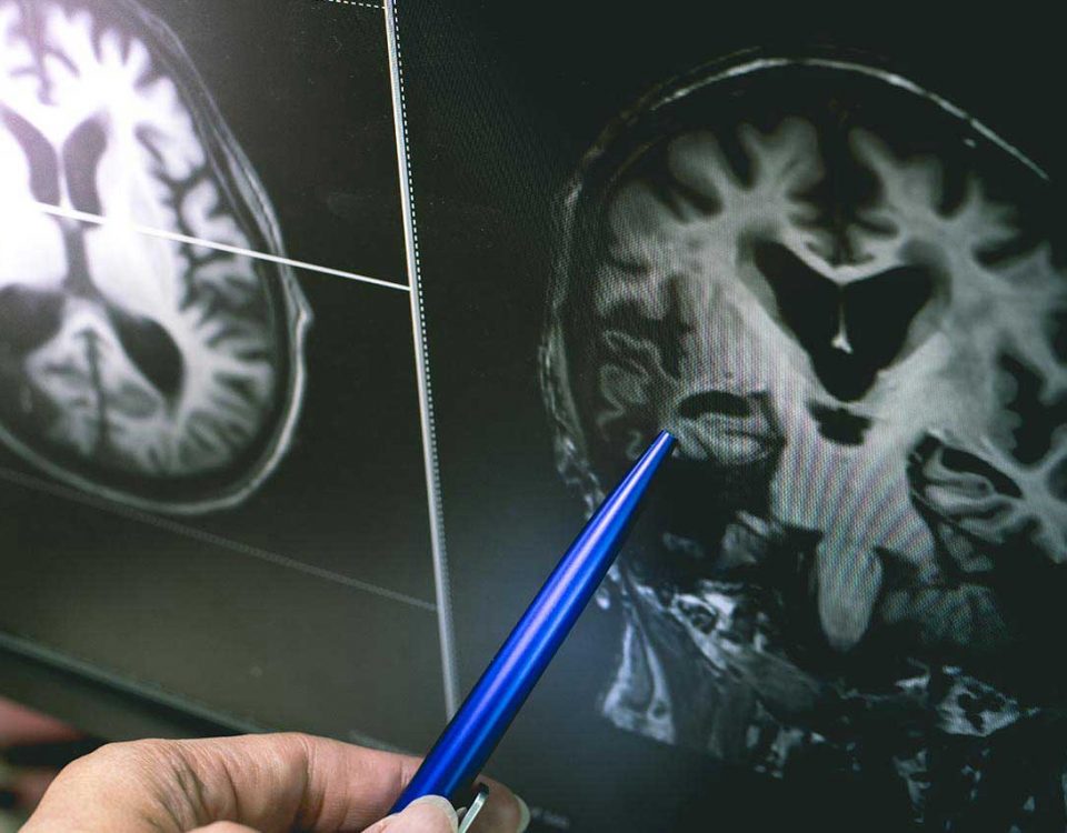 Addiction & The Brain: How Drugs Affect the Brain