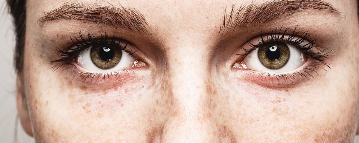 The Effects of Drugs on The Eyes