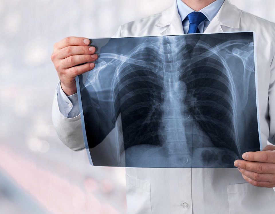 Lung Cancer Awareness Week
