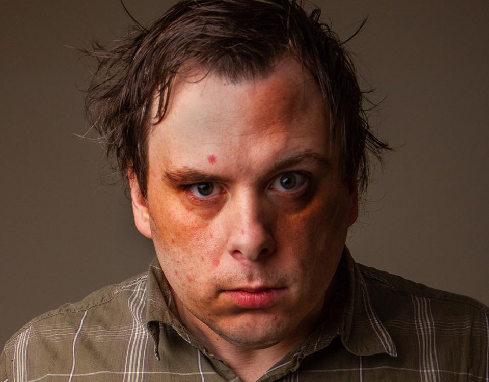 What Drugs Do to Your Face
