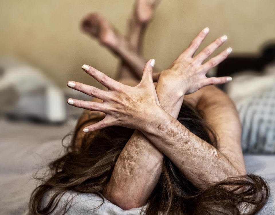 The Signs of Borderline Personality Disorder