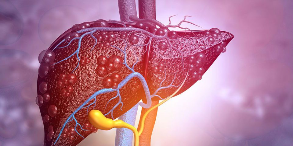 diseases caused by alcohol
