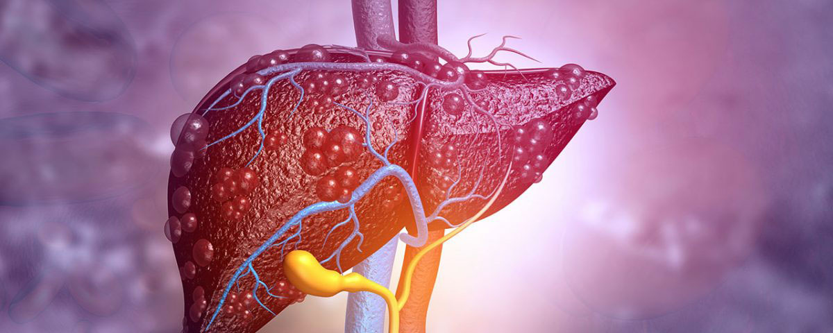 diseases caused by alcohol