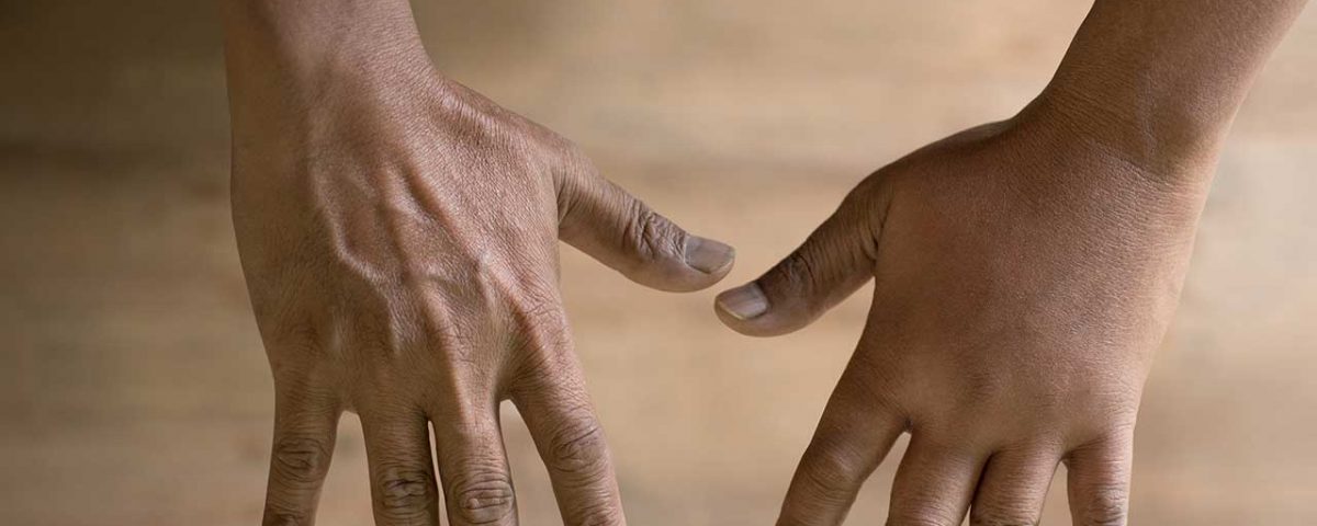 Puffy Hand Syndrome and Drug Abuse