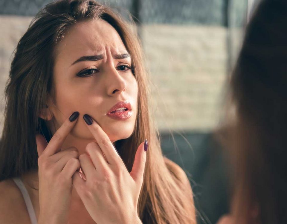 Does Alcohol Cause Acne?