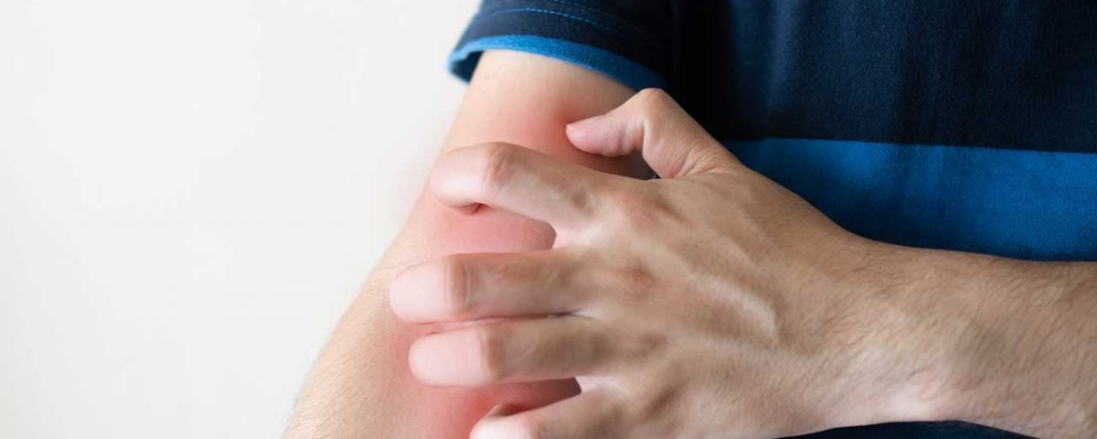 How to Stop Itching From Narcotics