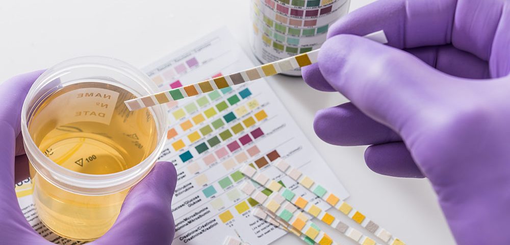 Drug Testing Programs Reducing Overdoses
