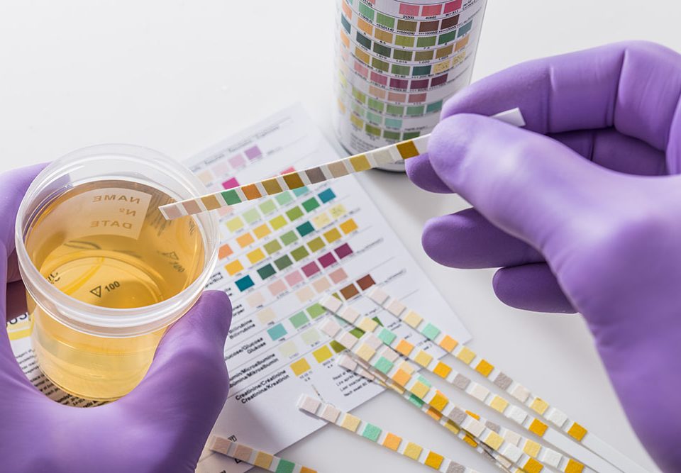 Drug Testing Programs Reducing Overdoses